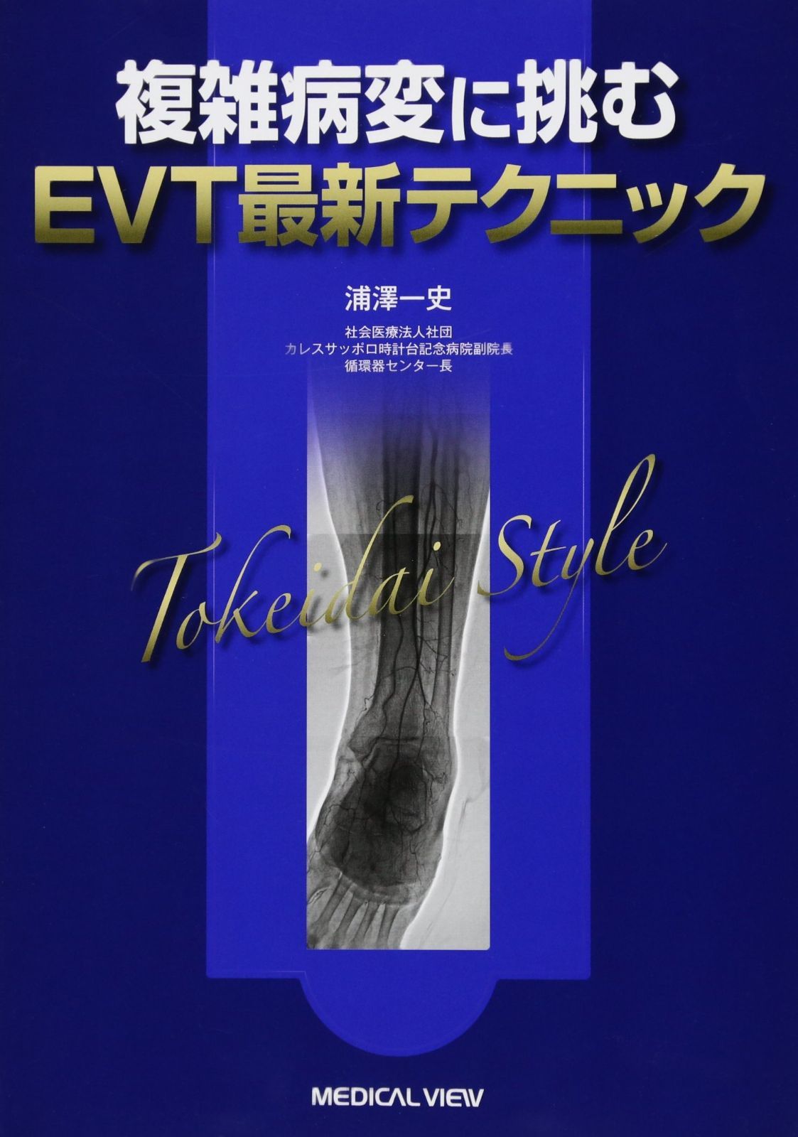 複雑病変に挑むEVT最新テクニック―Tokeidai Style