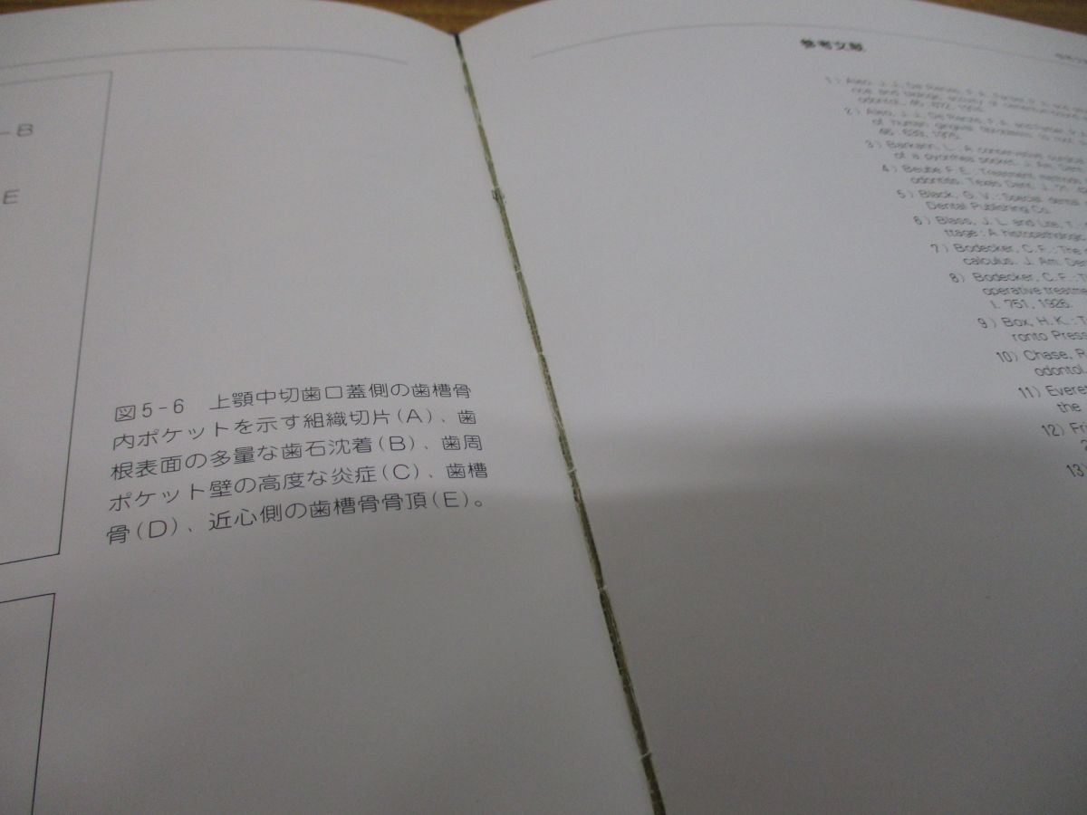 【中古】 カラーアトラス歯周治療学の臨床/クインテッセンス出版/松江一郎 △01)【同梱不可】カラーアトラス歯周治療学の臨床/松江一郎