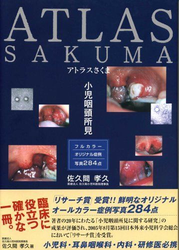 アトラスさくま: 小児咽頭所見