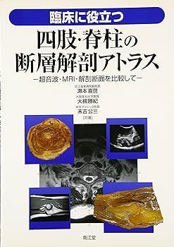 臨床に役立つ四肢・脊柱の断層解剖アトラス