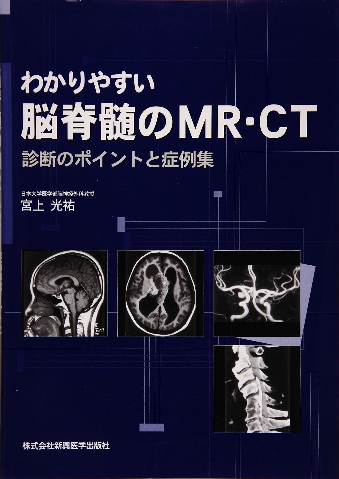 わかりやすい脳脊髄のMR・CT 購入