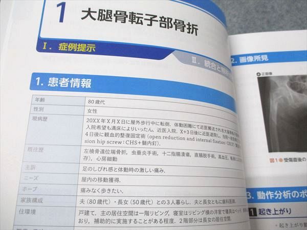 羊土社 症例動画でわかる 理学療法 臨床推論 統合と解釈 実践テキスト