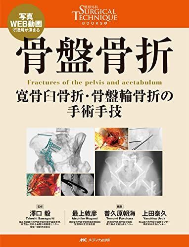 骨盤骨折 寛骨臼骨折 骨盤輪骨折の手術手技 整形外科SURGICAL TECHNIQUE BOOKS 9