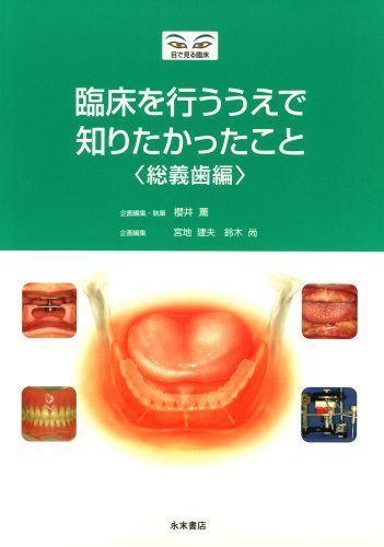 臨床を行ううえで知りたかったこと 総義歯編