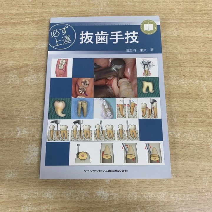 必ず上達 抜歯手技 ファッション本・雑誌・漫画 - 必ず上達 抜歯手技