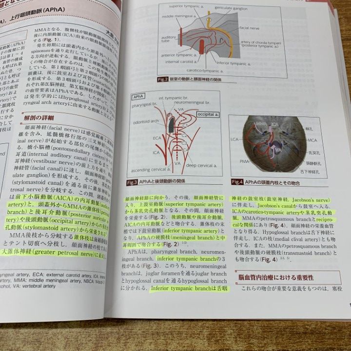 01 ! 完全版 脳血管内治療学 病態 治療法の本質的理解と臨床 研究発展のために 滝和郎 メディカ出版 2019年発行 医学 医療 A 健康 医学 本