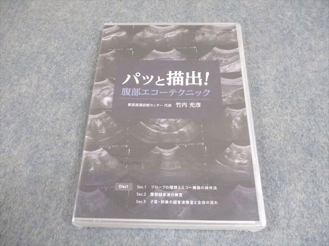 医療情報研究所 獣医学 パッと描出 腹部エコーテクニック DVD1巻 竹内充彦 016s3D
