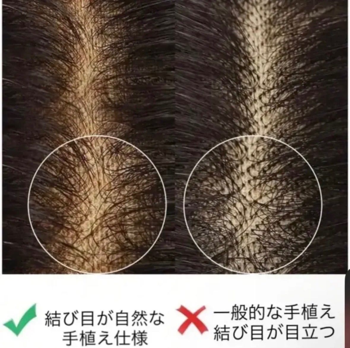 広範囲レース 人毛 人毛ウィッグ フルウィッグ かつら レースウィッグ 手植えウィッグ 医療用ウィッグ 自然 前髪あり ロングストレート ナチュラルブラウン ダークブラウン FORTGASGNV_COM_BR