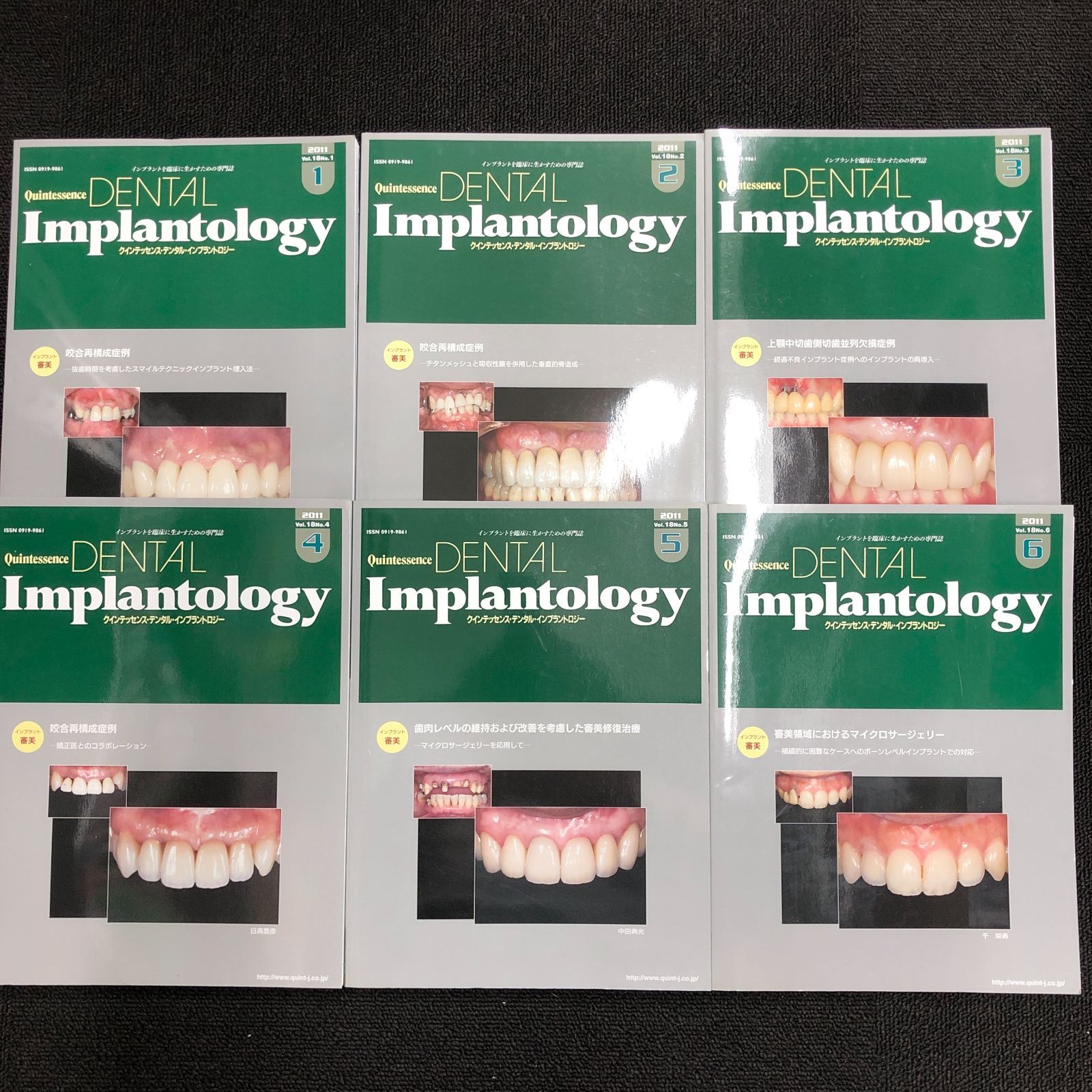 医学専門雑誌-歯科 クインテッセンス デンタル インプラントロジー 2011 VOL18１～6 全6冊セット インプラント審美