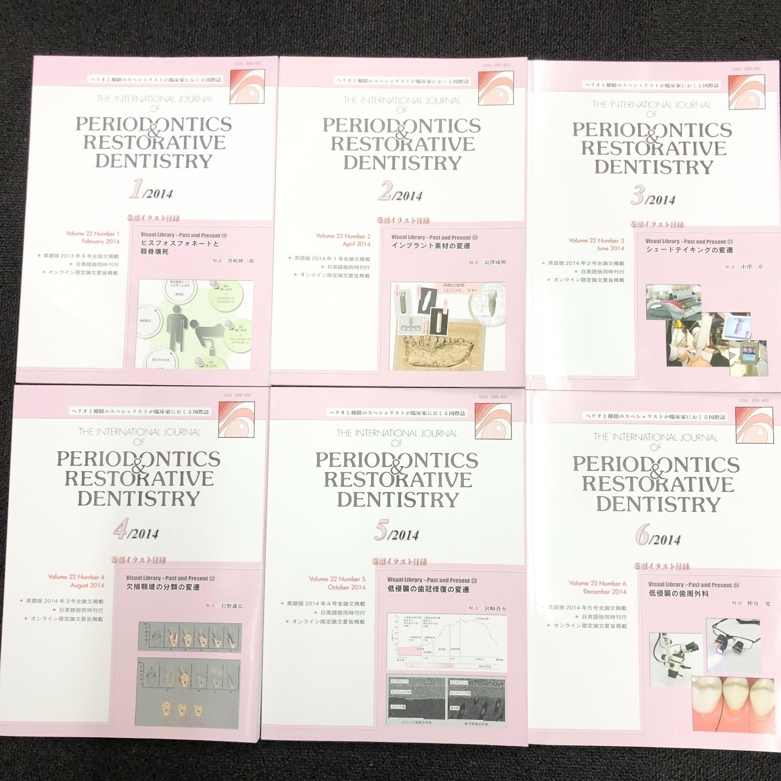 医学専門雑誌‐歯科 PERIODONTICS - RESTRATIVE DENTISTRY 2014 vol.22 1~6 ペリオと補綴のスペシャリストが臨床家に送る国際誌 全6冊セット 歯周病治療