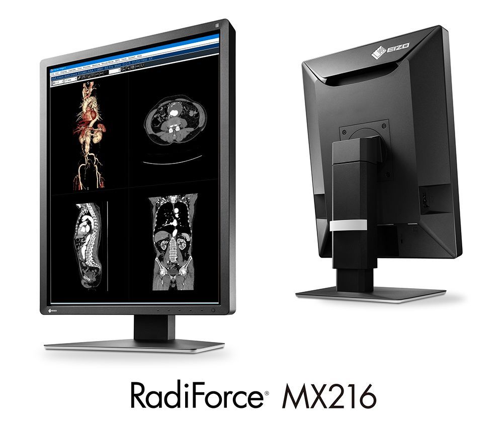 EIZO エイゾー RadiForce MX216｜21.3型 医用画像モニター｜IPS DICOM対応 DisplayPort DVI-D