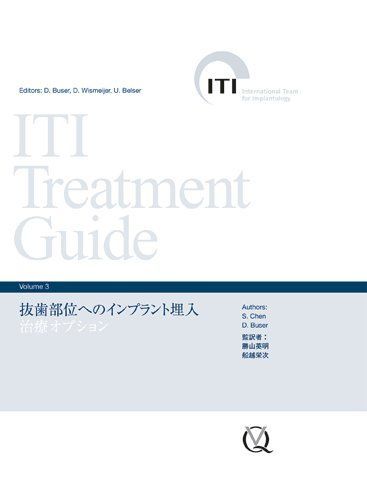 ITI Treatment Guide Volume 3 抜歯部位へのインプラント埋入