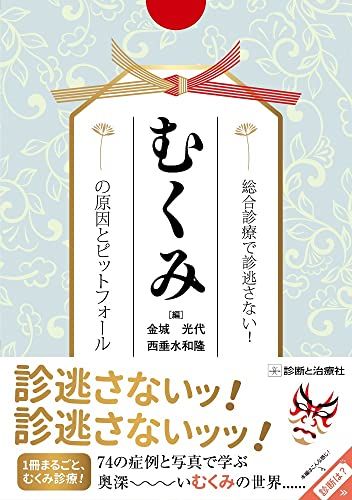総合診療で診逃さない むくみの原因とピットフォール 金城 光代 西垂水 和隆