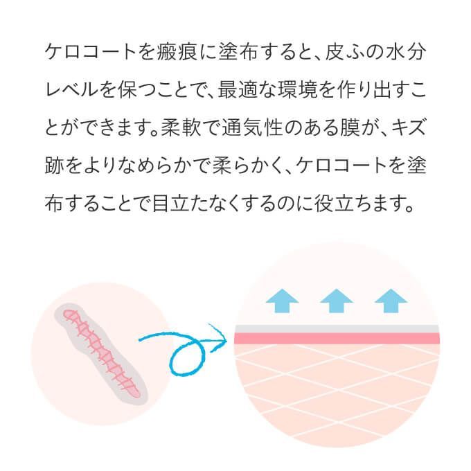 2個セット kelo-cote