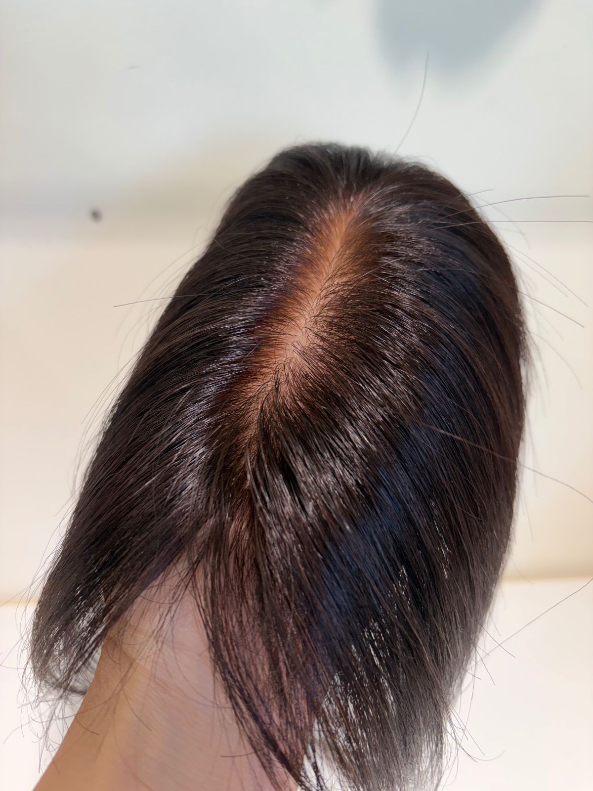 一点 薄毛 分け目 ヘアピース 部分かつら