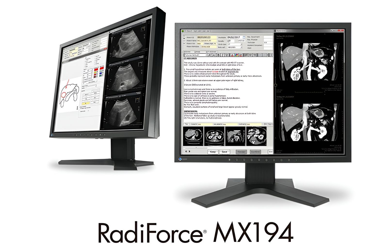 EIZO エイゾー RadiForce MX194|19インチ 医用画像表示モニター 1280×1024 DisplayPort DVI-D USB2.0