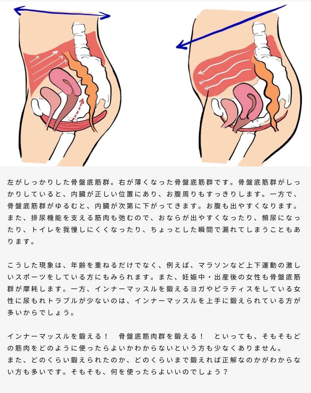 腟のゆるみが気になる方に