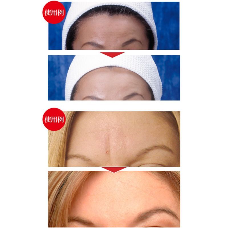 144ピース入り 3箱セット