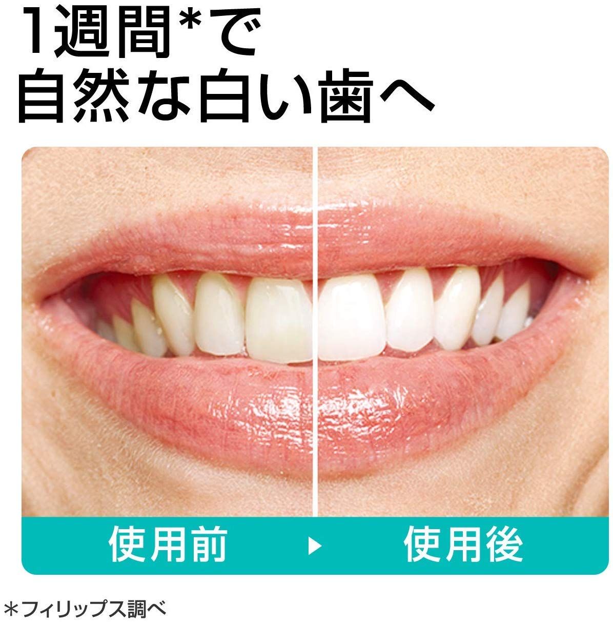 エディション 電動歯ブラシ