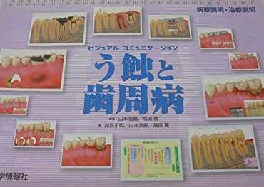 う蝕と歯周病 ビジュアルコミュニケーション 山本 浩嗣 高田 隆