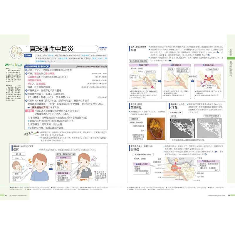 病気がみえる vol.13 耳鼻咽喉科 第1版 0 - メルカリ