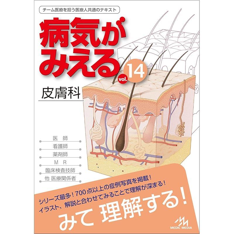 病気がみえる vol.14 皮膚科 第1版 1 【公式通販】