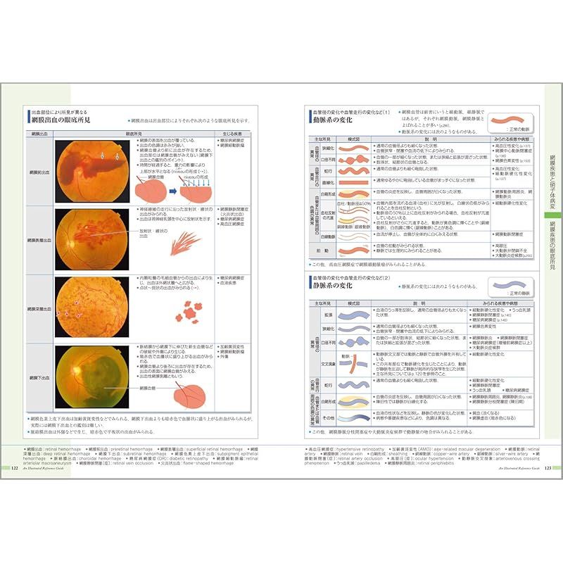 病気がみえる vol.12 眼科 第1版 1 - メルカリ