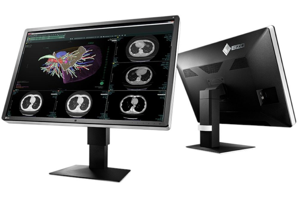 EIZO RadiForce RX660-AR 30型 6MP 医用画像モニター|CR DR CT MRI 超音波対応|3280×2048 IPS ノング 狭額縁|DisplayPort DVI USB|MFD 2025-09-08