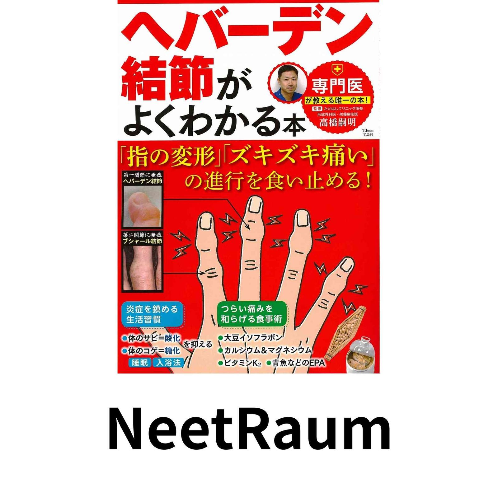 ヘバーデン結節がよくわかる本 指の変形 ズキズキ痛い の進行を食い止める! TJMOOK 高橋 嗣明