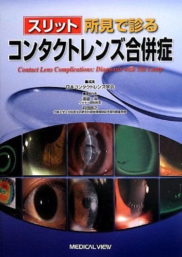スリット所見で診る コンタクトレンズ合併症 日本コンタクトレンズ学会