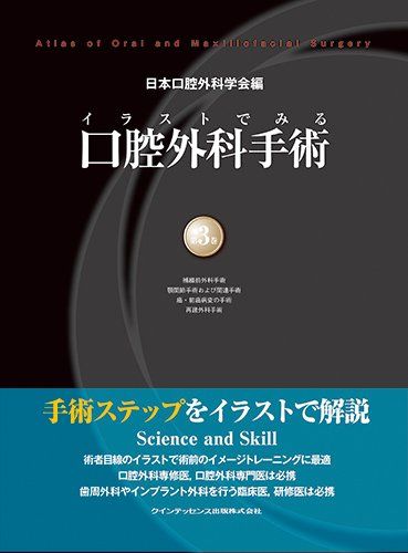 イラストでみる口腔外科手術 第3巻 イラストでみる口腔外科手術 第