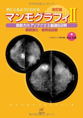 手にとるようにわかるマンモグラフィ  ２ 改訂版/ベクトル・コア/松永忠東（単行本） マンモグラフィII 改訂版−読影力をアップさせる厳選62例−【解説強化