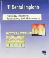 Iti Dental Implants: Planning， Placement， Restoration， and Maintenance [ハードカバー] Wilson， Thomas G.， Jr. Iti Dental Implants: Planning， Placement， Restoration， and