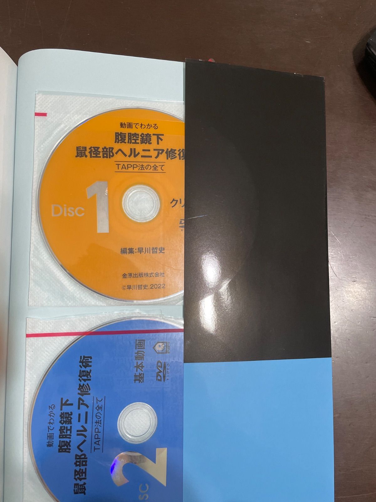 動画でわかる腹腔鏡下鼠径部ヘルニア修復術ーTAPP法のすべてー | 早川