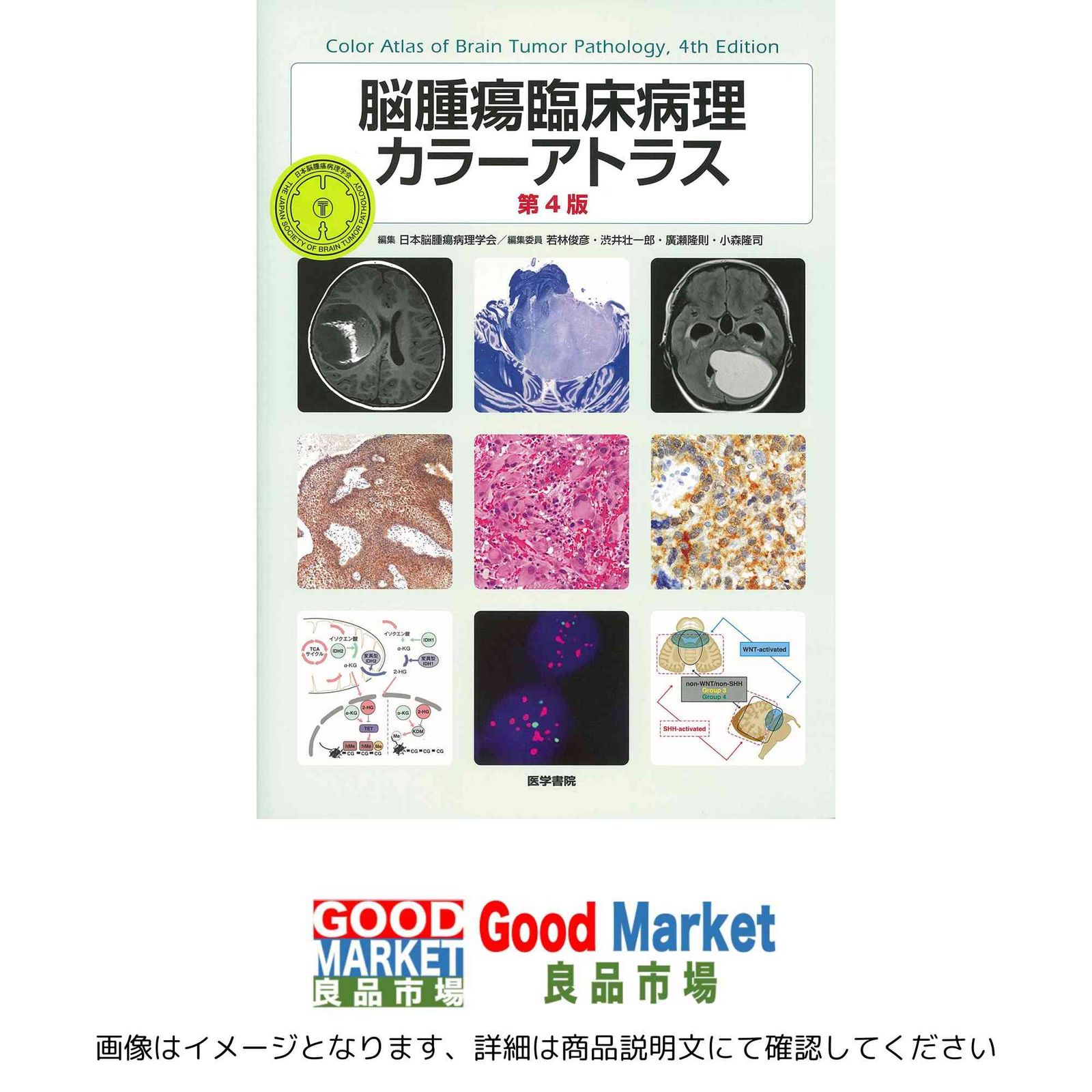 脳腫瘍臨床病理カラーアトラス 第4版 日本脳腫瘍病理学会? 若林俊彦