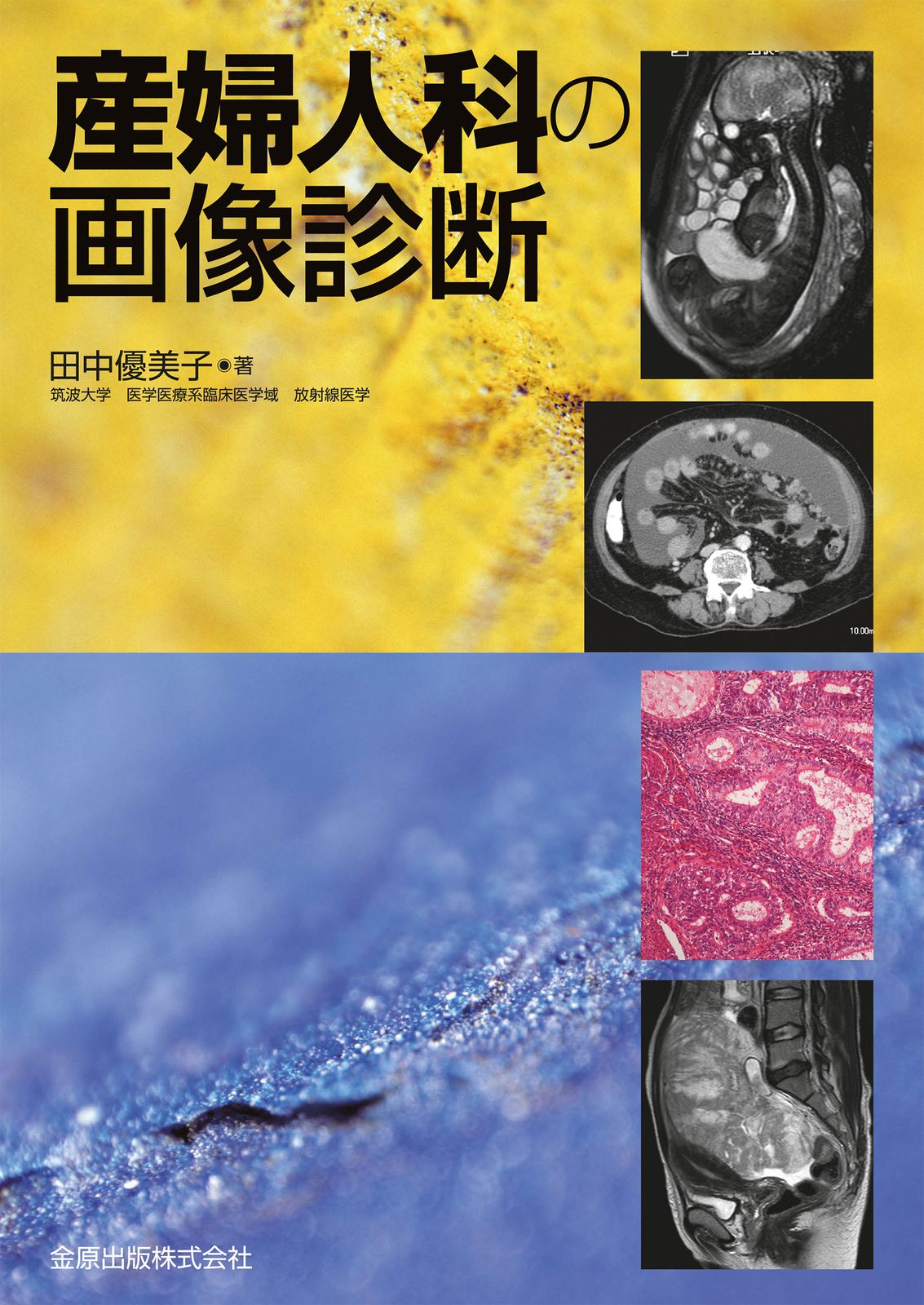 産婦人科の画像診断 金原出版 田中優美子 単行本