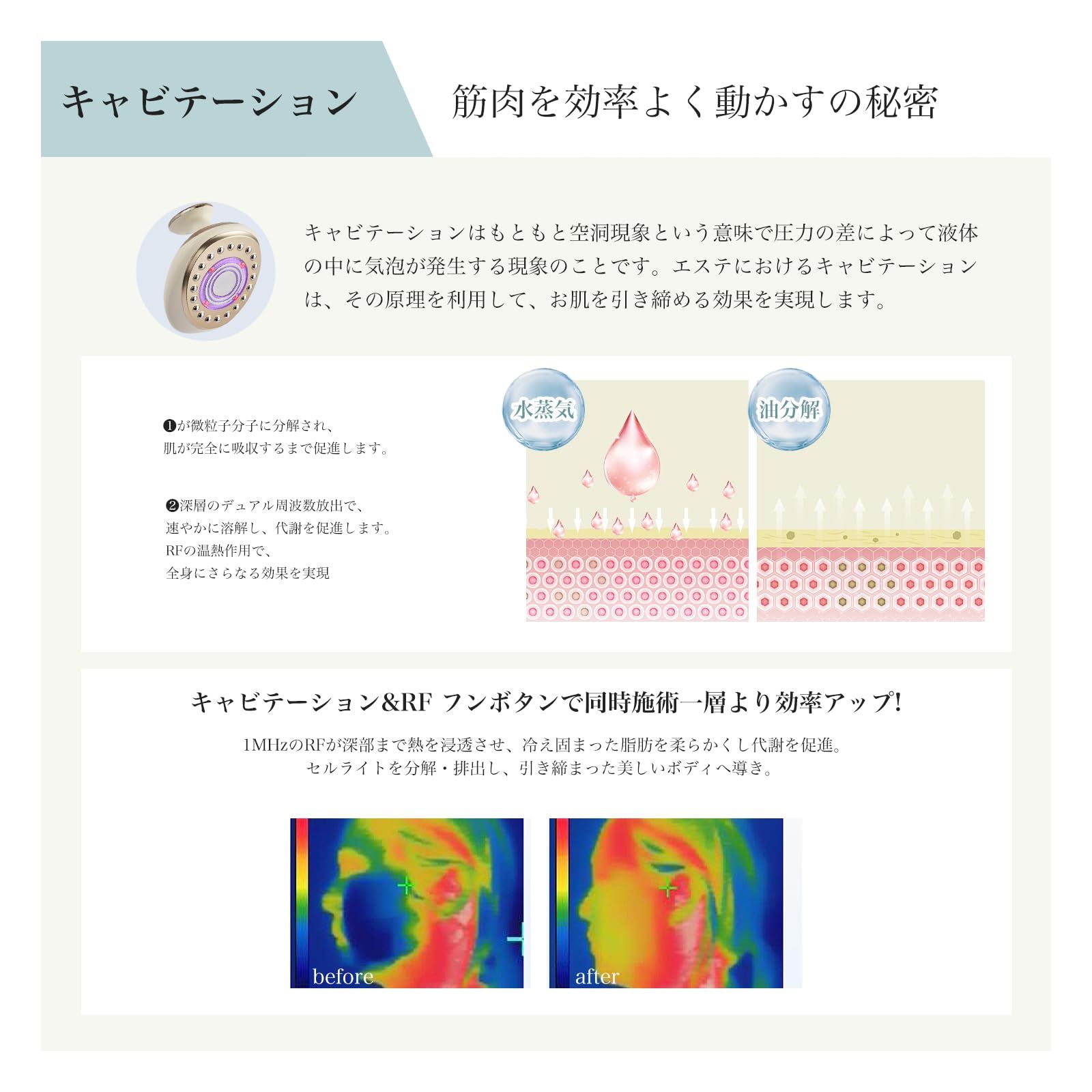 yete 美顔器 ボディ美容器 1台多役 超音波 RF 5段階の強度調節 EMS 