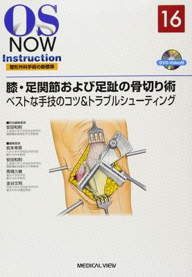 膝 足関節および足趾の骨切り術−ベストな手技のコツ-トラブルシューティング DVD付 OS NOW Instruction