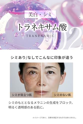 トラネキサム酸