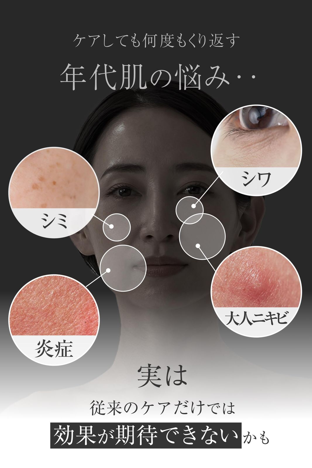 ナイアシンアミド