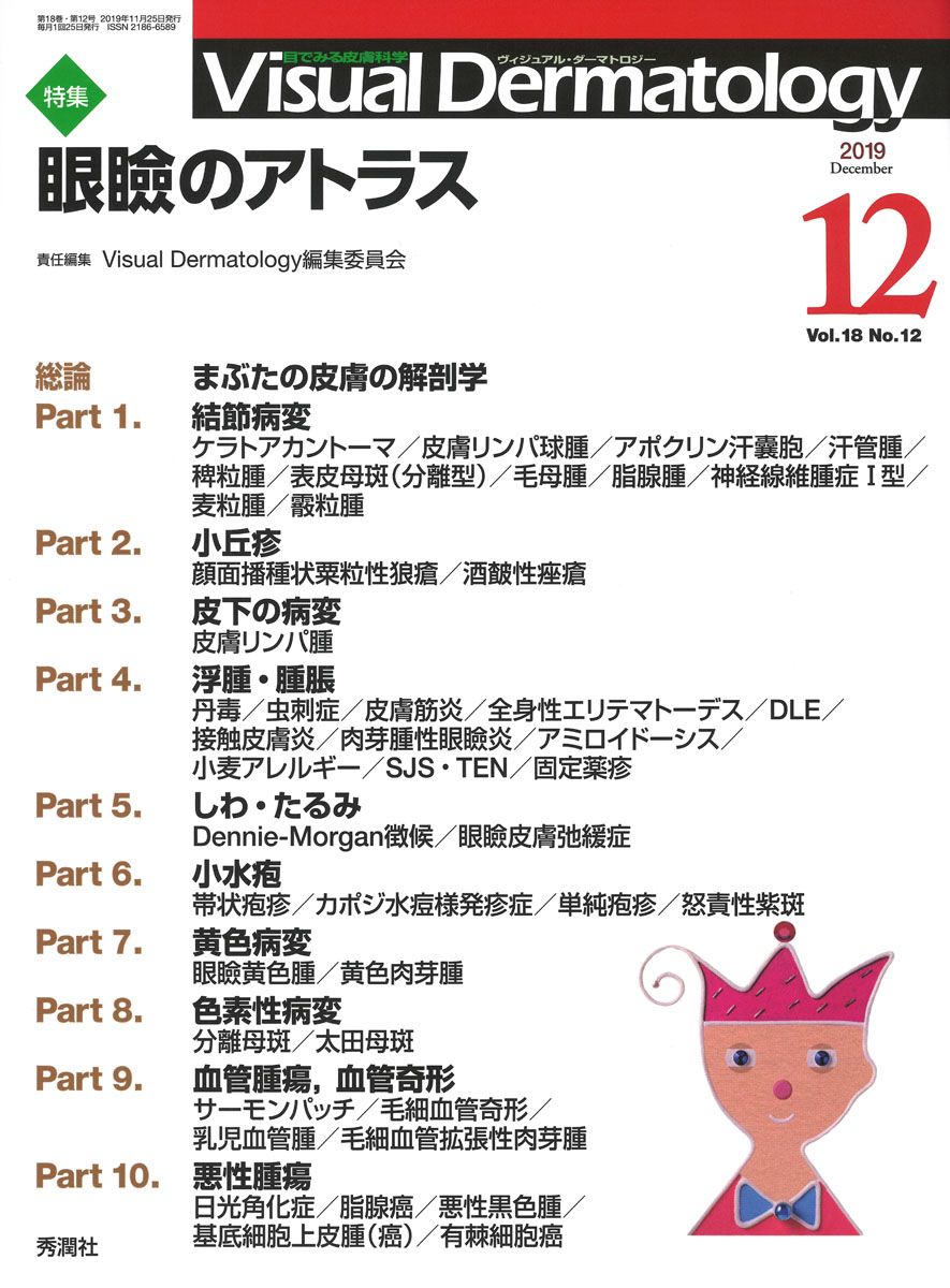 正規品，低価 Ｖｉｓｕａｌ　Ｄｅｒｍａｔｏｌｏｇｙ 目でみる皮膚科学 Ｖｏｌ．１８　Ｎｏ．１２（２０/学研メディカル秀潤社（大型本） その他