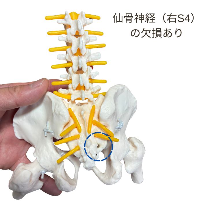 アウトレット】人体模型 1/2サイズの動かせる大腿骨付き骨盤模型
