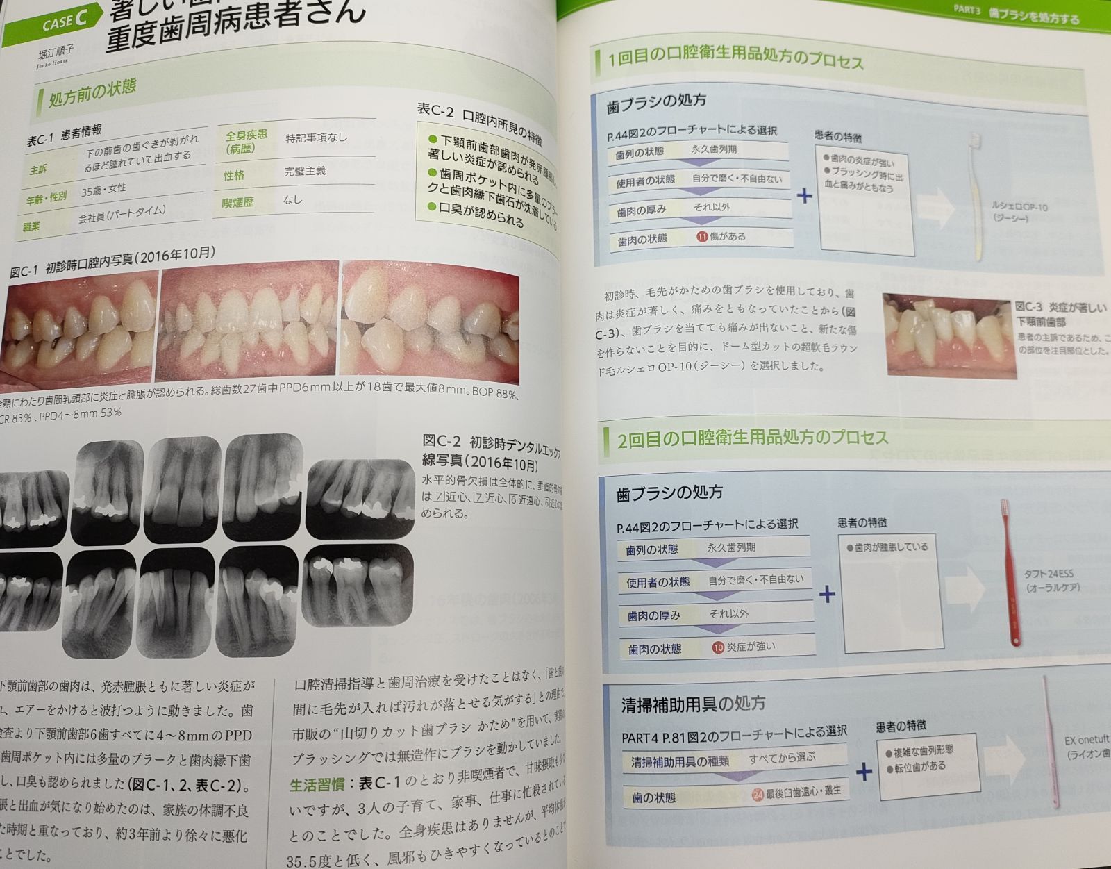 別冊衛生士 歯ブラシ処方箋 歯ブラシ編 「患者さんのために選んだ1本」