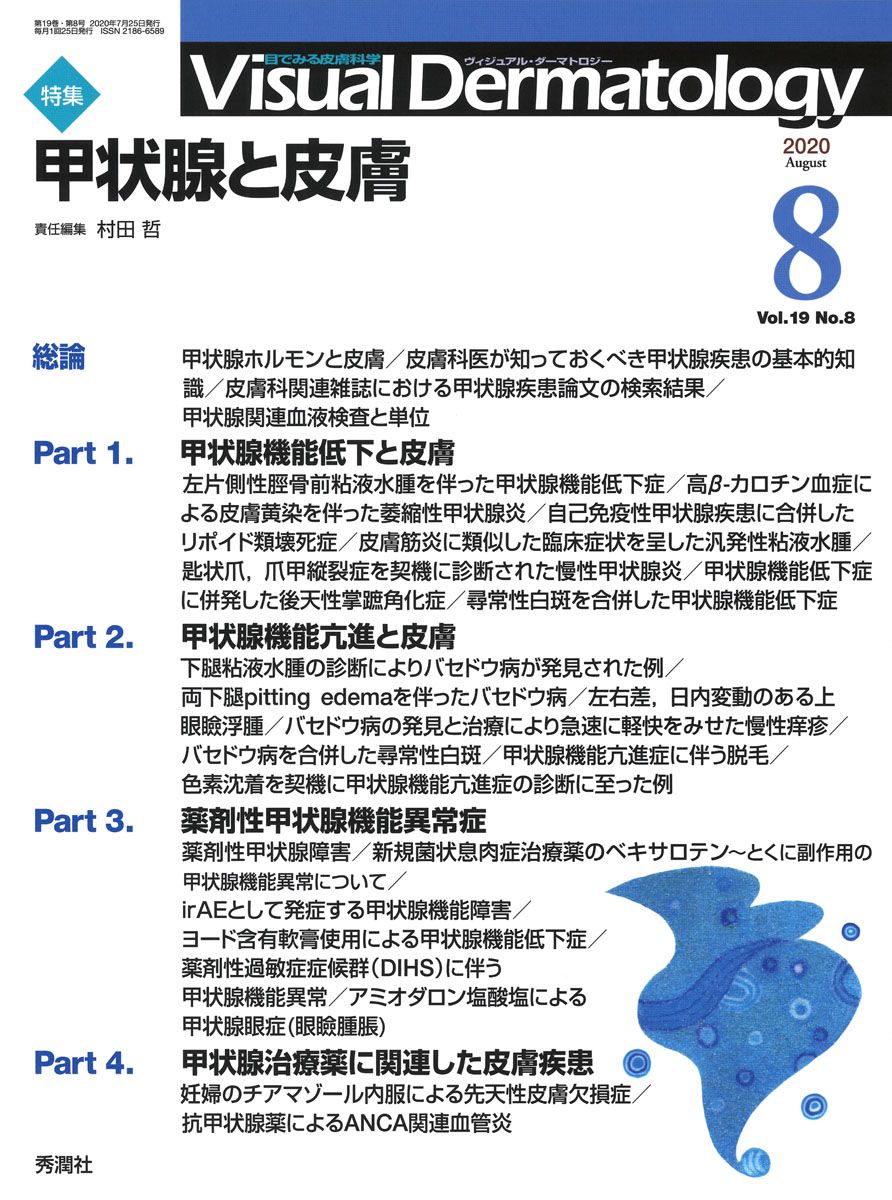 新作登場，豊富な Ｖｉｓｕａｌ　Ｄｅｒｍａｔｏｌｏｇｙ 目でみる皮膚科学 Ｖｏｌ．１９　Ｎｏ．８（２０２/学研メディカル秀潤社（大型本） その他
