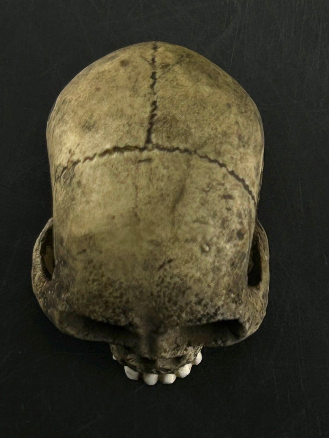 セット ガイコツ