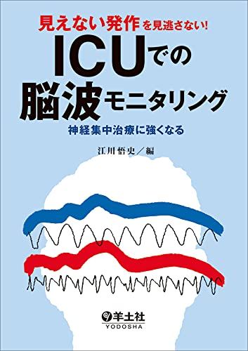 見えない発作を見逃さない！ICUでの脳波モニタリング?神経集中治療に強くなる