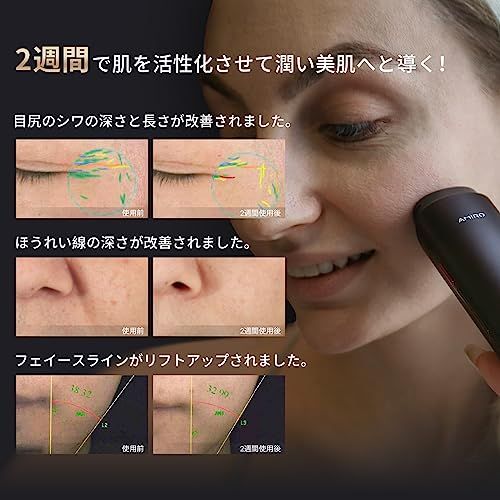 AMIRO 美顔器 EMS 1台10役 ラジオ波 RF美容器 肌引き締め 表情筋ケア