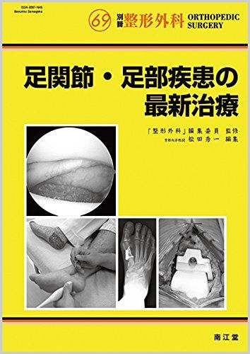 本 足関節・足部疾患の最新治療 (別冊整形外科 no.69)