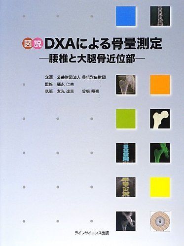 図説DXAによる骨量測定―腰椎と大腿骨近位部―
