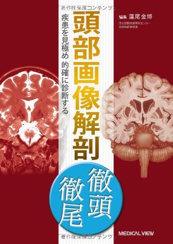 頭部画像解剖 徹頭徹尾―疾患を見 め的確に診断する